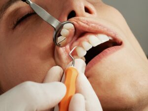 Dentalbegriffe verstehen